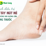 7 cách điều trị chân tay nứt nẻ vào mùa đông mà không cần dùng thuốc