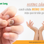 Hướng dẫn cách chữa móng tay thối hiệu quả từ dân gian