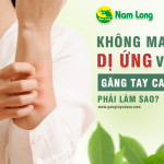 Không may bị dị ứng với găng tay cao su thì phải làm gì?