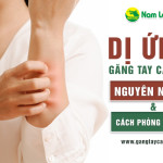 Dị ứng găng tay cao su: Nguyên nhân và cách phòng tránh