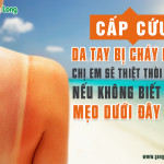 9 mẹo chữa da tay bị cháy nắng nhanh nhất tại nhà