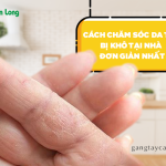 Cách chăm sóc da tay bị khô tại nhà đơn giản nhất