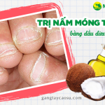 Mách bạn bí quyết trị nấm móng tay bằng dầu dừa hiệu quả bất ngờ