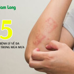Đề phòng 5 loại bệnh lý về da nguy hiểm hay gặp vào mùa mưa