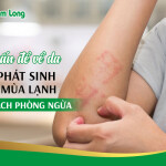 7 vấn đề về da dễ phát sinh vào mùa lạnh và cách phòng ngừa
