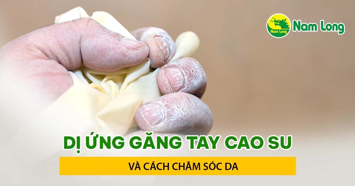 Di ung gang tay cao su va cach khac phuc