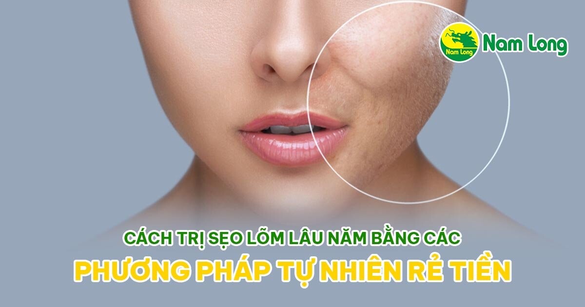 cach tri seo lom lau nam bang phuong phap tu nhien