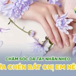 Chăm sóc da tay nhăn nheo khi rửa chén bát chị em nên nhớ